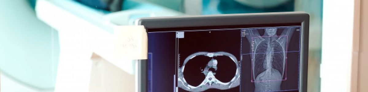 Opinión: Día Mundial de la Protección Radiológica: un homenaje a los tecnólogos médicos en primera línea