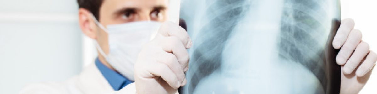Salud: ¿Cómo una radiografía puede ayudar al diagnóstico de COVID-19?
