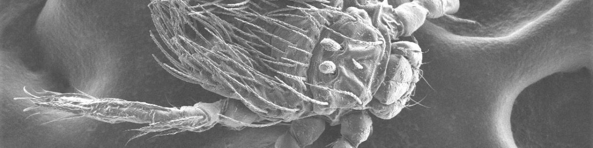 “Tifus de los matorrales”: Científica de la UCM expone hallazgos sobre enfermedad emergente