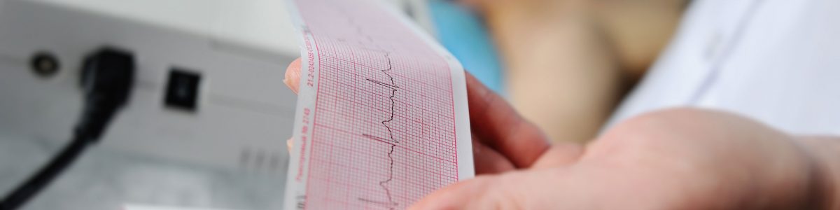 No reconocer los síntomas es el principal error para tratar con éxito un infarto