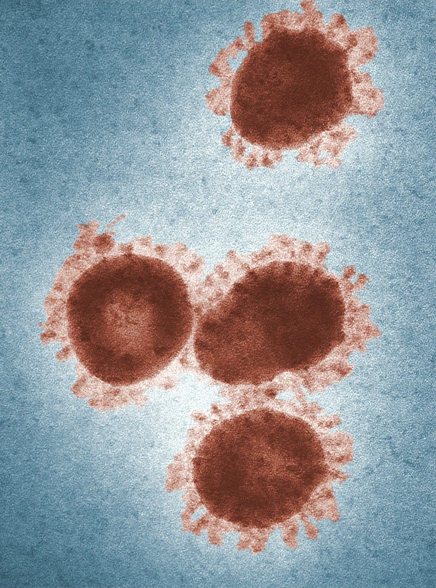 Grupo de 14 países han confirmado casos de coronavirus