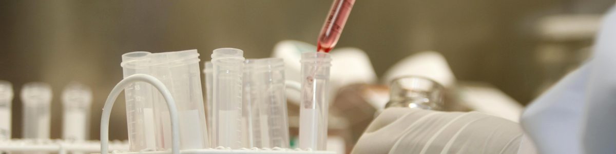Residuos agroindustriales son fuente de beneficios alimentario y de salud